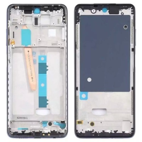 شاسی شیائومی Xiaomi Poco X3